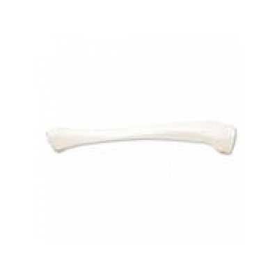 Tibia, Right