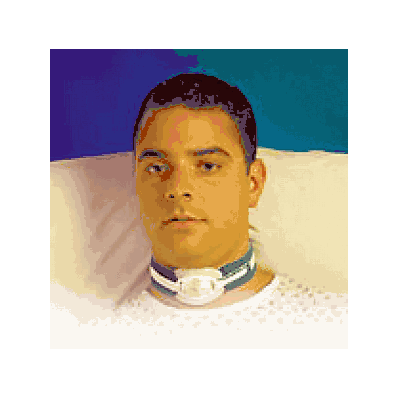 Tie, Rach, Pediatric, 1 Pc - Medline