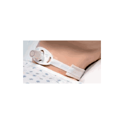Tracheostomy Collar, Trach Collar Size 16" - 20"