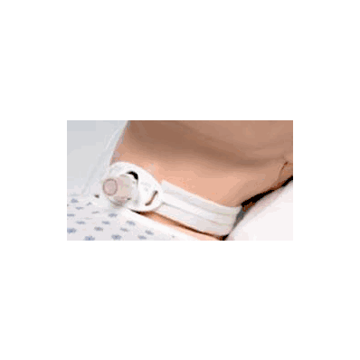 Tracheostomy Collar - Collar, Trach W/7.5 AdD