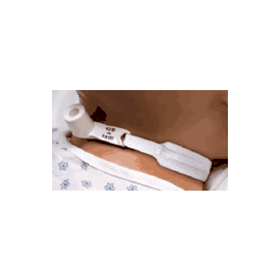 Tracheostomy Collar - Trach, Collar Pediatric