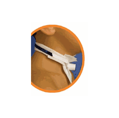 Tracheostomy Tube Neckband Pedi-tie - Tie, T