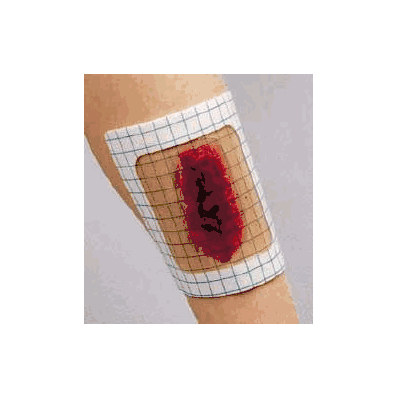 Transparent Dressing Clearsite Polyurethane