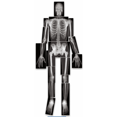 True-to-Life Human X-Rays, 5 ft tall