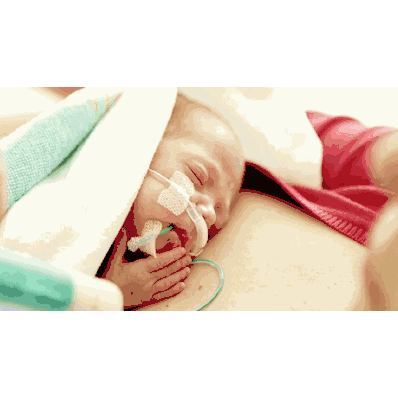 Tube, 2.40 mL, 42", 8 Fr. Neonatal Gasogastic
