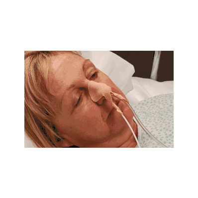 Tube Holder, Nasogastric feeding and aspiration tubes
