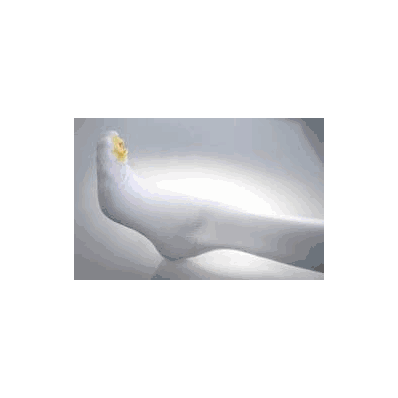 Ultra C.A.R.E Anti-embolism Stockings Thigh-