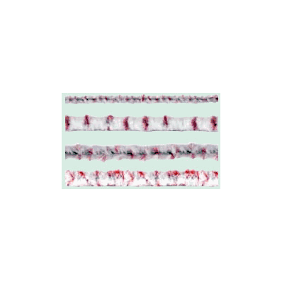 Ultra Channel Cleaner, Complete Refill Pack -
