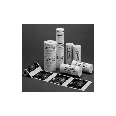 Ultrasound / Obgyn Recording Paper Thermafilm