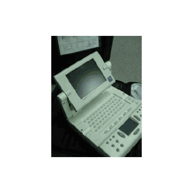 Ultrasound System 2d Black And White Imaging