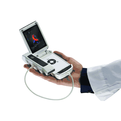 Ultrasound System, Handheld Vscan