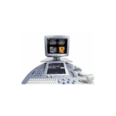Ultrasound System Voluson 7304d - Ultrasound