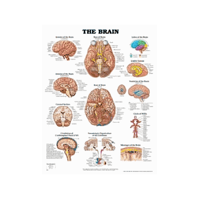 Understanding Stroke - Medline