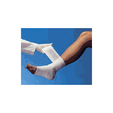 Unna Boot Bandage 4 Inch X 10 Yard - Unnaboot