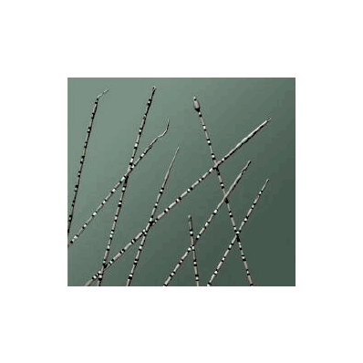 Ureteral Catheter, 3 Fr., 70 cm Whistle Tip