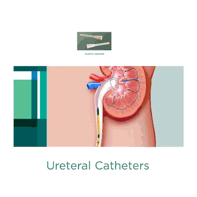 Ureteral Catheter Adapter
