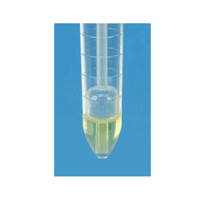 Urinalysis Tube, 15 mL Plain Conical Bottom