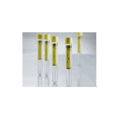 Urine Collection Tube Vacuette Round Bottom