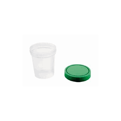 Urine Specimen Container Amsure Screw-on Lid