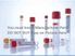 Vacuette #456048 Red/Black Ring, 13x100mm, 6 ml Transparent Label, Non-ridged (pull cap) Z Serum Clot Activator, sold as 1200/Case by Greiner Bio-one<br><br><font color="red"><b>BACK TO THE PRODUCT TABLE, <a href="https://www.aaawholesalecompany.com/clinical-laboratory-laboratory-glassware-and-plasticware-greiner-bio-one-vacuette-serum-pull-cap.html">CLICK HERE</a></b></font>