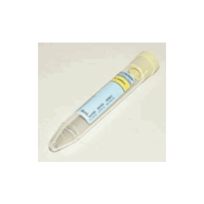 Vacutainer BD 364980, Urine Collection Tube