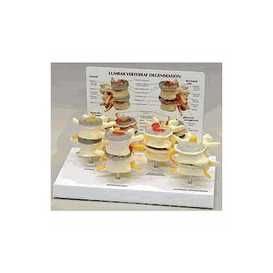 Vertebrae Set Model - Model, Vertebrea Set 4s