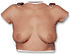 Wearable Breast Self-Examination Model, sold as each by 3B Scientific, Nasco SB41504 <br><br><font color="red"><b>BACK TO THE PRODUCT TABLE, <a href="https://www.aaawholesalecompany.com/nasco-simulation-learning-anatomy-training-breast-self-examination-model.html">CLICK HERE</a></b></font>