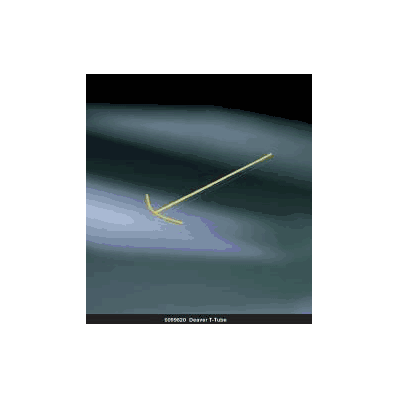Wound Drain, 10 Fr. T-Tube Deaver without Attachment