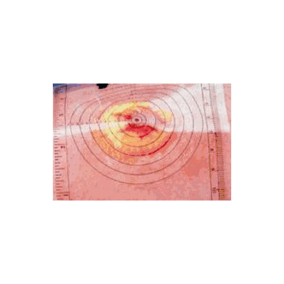 Wound Measuring Guide 5.25 X 3.25 Inch - Meas