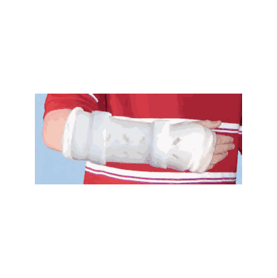 Wrist Fracture Orthosis - Extra Small Ri