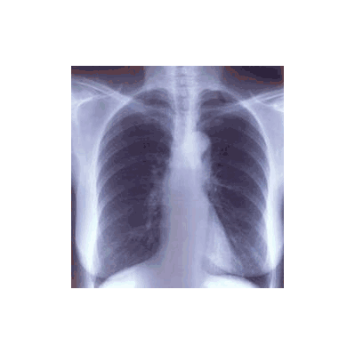 X-ray Film Clear Choice Performance 10 X 12