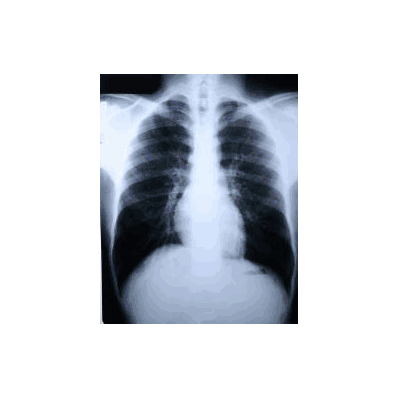 X-ray Film Clear Choice Performance 14 X 17