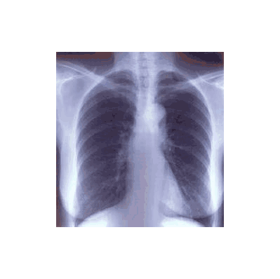 X-ray Film Clear Choice Performance 9.5 X 9.