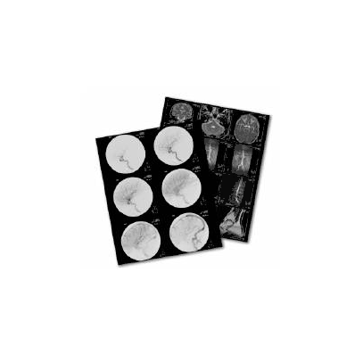 X-ray Film Radiomat Dm 1b 14 X 17 Inch High