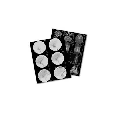 X-ray Film Radiomat Dm 2b 14 X 17 Inch High
