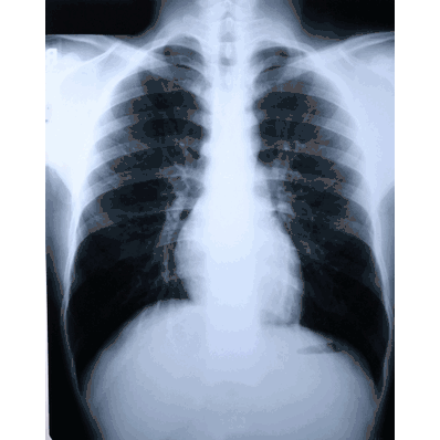 X-Ray Film, SIZE (7" X 17"), Green Sensitive, sold as 500/CS, Medium Speed