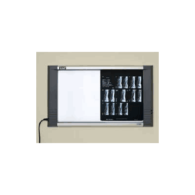 X-ray Illuminator Insight Series 2 Bank 1 Tie