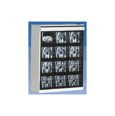 X-ray Illuminator Mg-7 2-banks 1-tier 2-lamps
