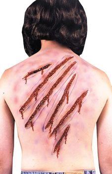 Prosthetic Wounds<br> Whip Lash Wounds<br> Glue On<br> WND27