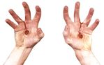 Prosthetic Wounds<br> Whip Lash Wounds<br> Glue On<br> WND27