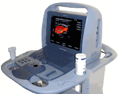 Acuson Cypress PLUS Portable Ultrasound