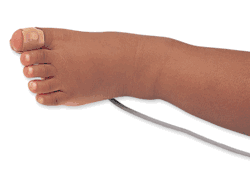 Nellcor Infant Adhesive SpO&#8322; Sensor