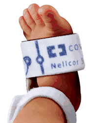 Nellcor Preemie SpO&#8322; Sensor Nonadhesive