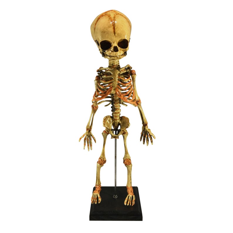 Baby Fetus Skelton
